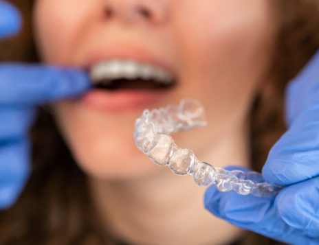 Finding the Best Invisalign® Provider in Southampton